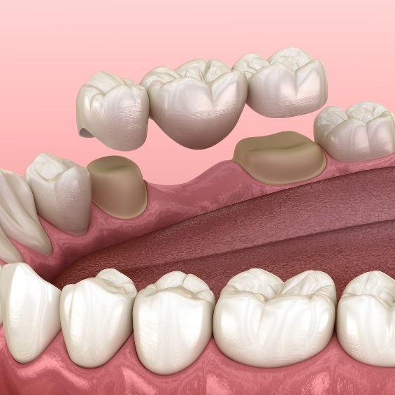 woman smiling during dental visit in Simpsonville