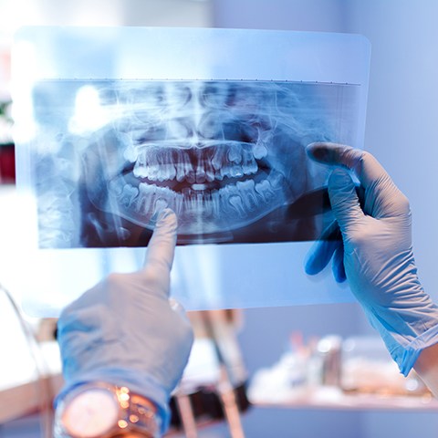 Dentist in Powdersville reviewing X-rays