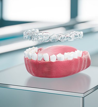 Model of teeth and aligner for ClearCorrect® in Greenwood, SC