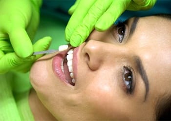 A woman lying in the dentist’s chair while a dental professional uses a shade guide to identify the correct color for her veneers
