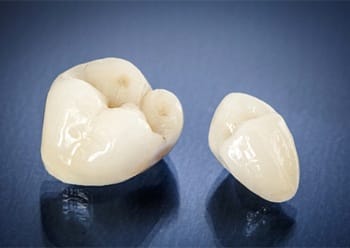 Two types of dental crowns that are metal-free and prepared for placement