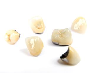 A series of dental crowns in Powdersville, SC.
