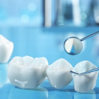 A dental bridge near implant parts against a blue background