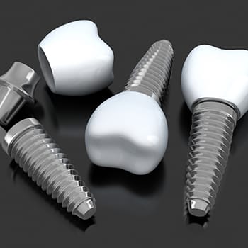 Different types of dental implants in Simpsonville on dark background