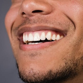 Closeup of smiling man with dental implants in Simpsonville 