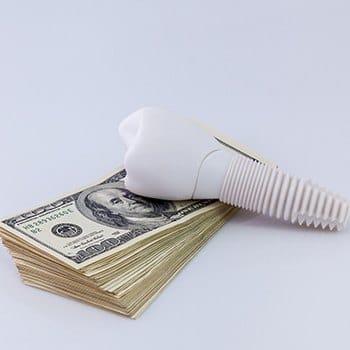 Model implant and money stack representing the cost of dental implants in Simpsonville