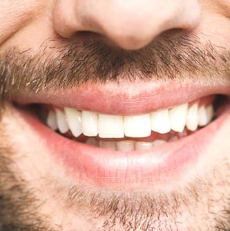 Close-up of man’s white smile