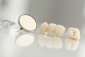 Your Tylan Creek dental team uses CEREC in Piedmont. 