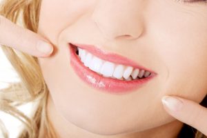 woman smiling perfect teeth