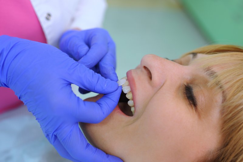 person replacing veneers at dentist