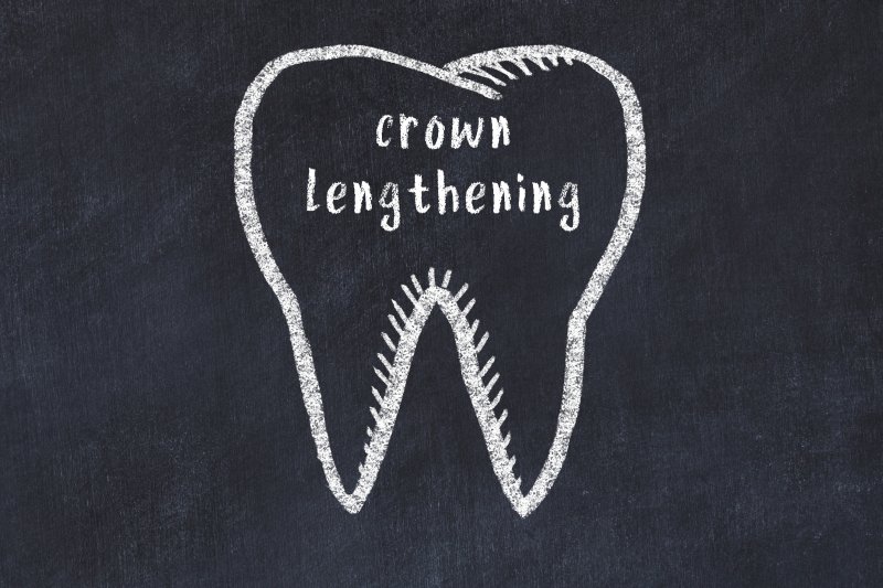 An illustrated tooth with the words 'crown lengthening'