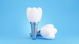 Two model dental implants on a light blue background