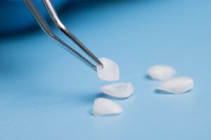 Dentist picking up veneers