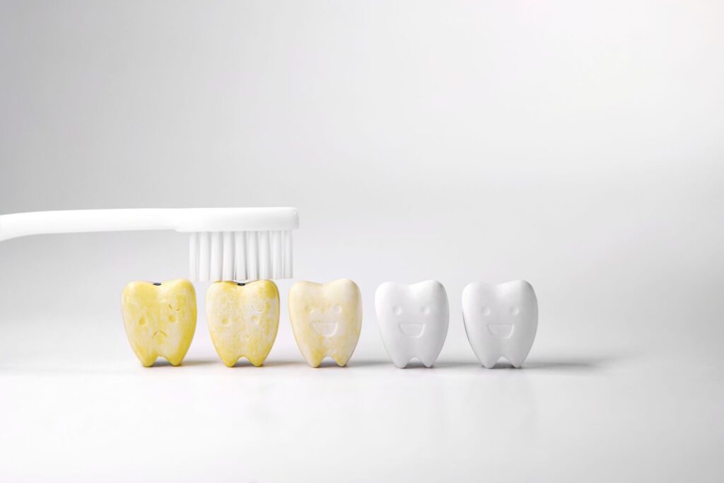 A computer-generated image of a series of discolored teeth