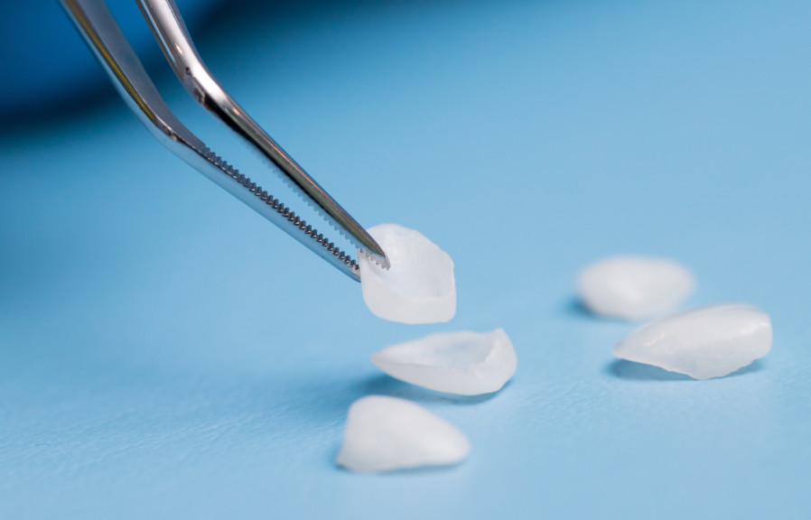Close up of veneers